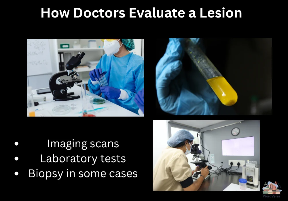 How Doctors Evaluate a Lesion