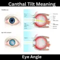 Canthal Tilt Meaning