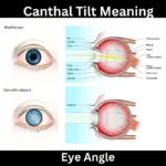 Canthal Tilt Meaning