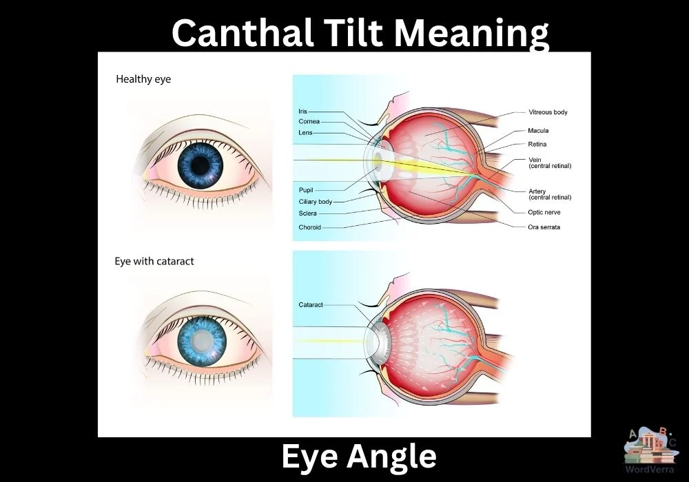 Canthal Tilt Meaning