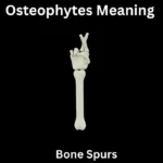 Osteophytes Meaning