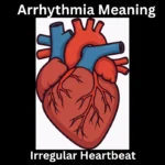 Arrhythmia Meaning